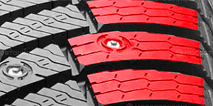 Технология 3D шынтақ аймағының ламельдері